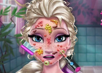 Ice Queen Skin Doctor екранна снимка на играта