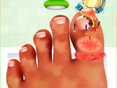 لعبة جراحة الأظافر لقطة شاشة اللعبة